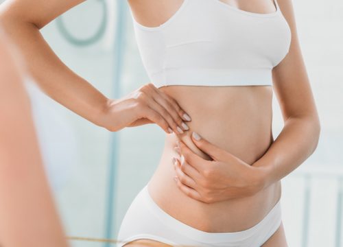 Stretch marks on a woman's side